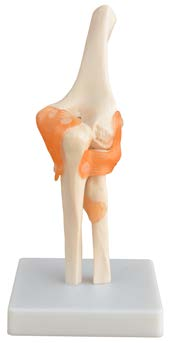 Life-Size Elbow Joint