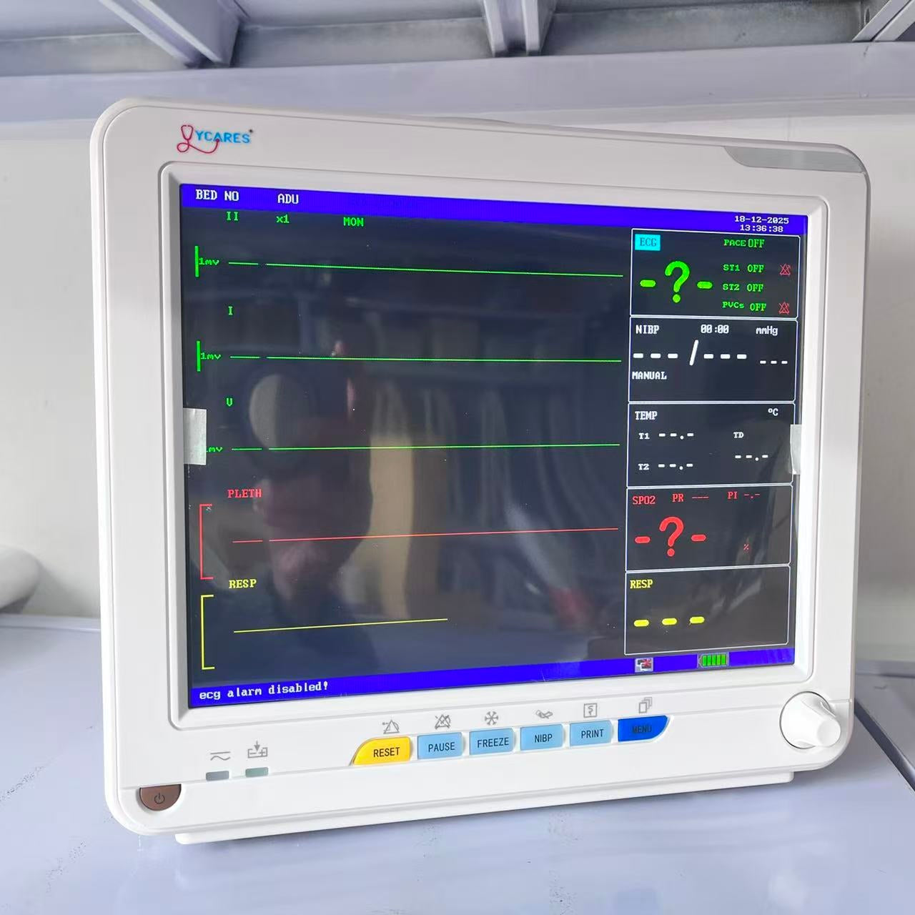 Multiparameter Patient Monitor: 6 Vital Signs (ECG/NIBP/SpO₂) | 12.1" TFT Display | 3H Battery
