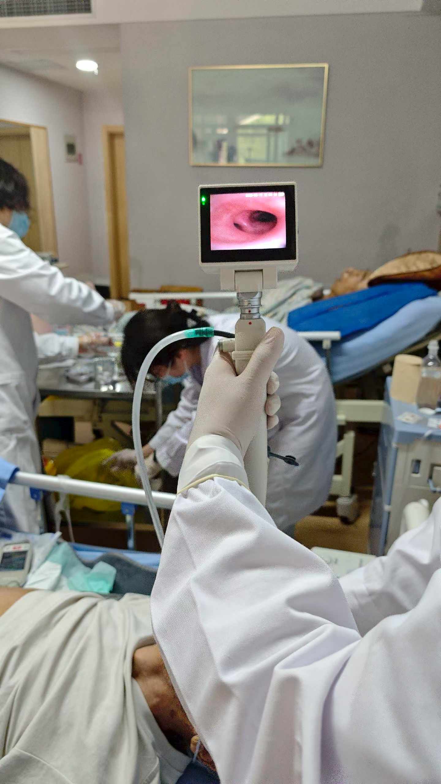 Electronic Bronchoscope