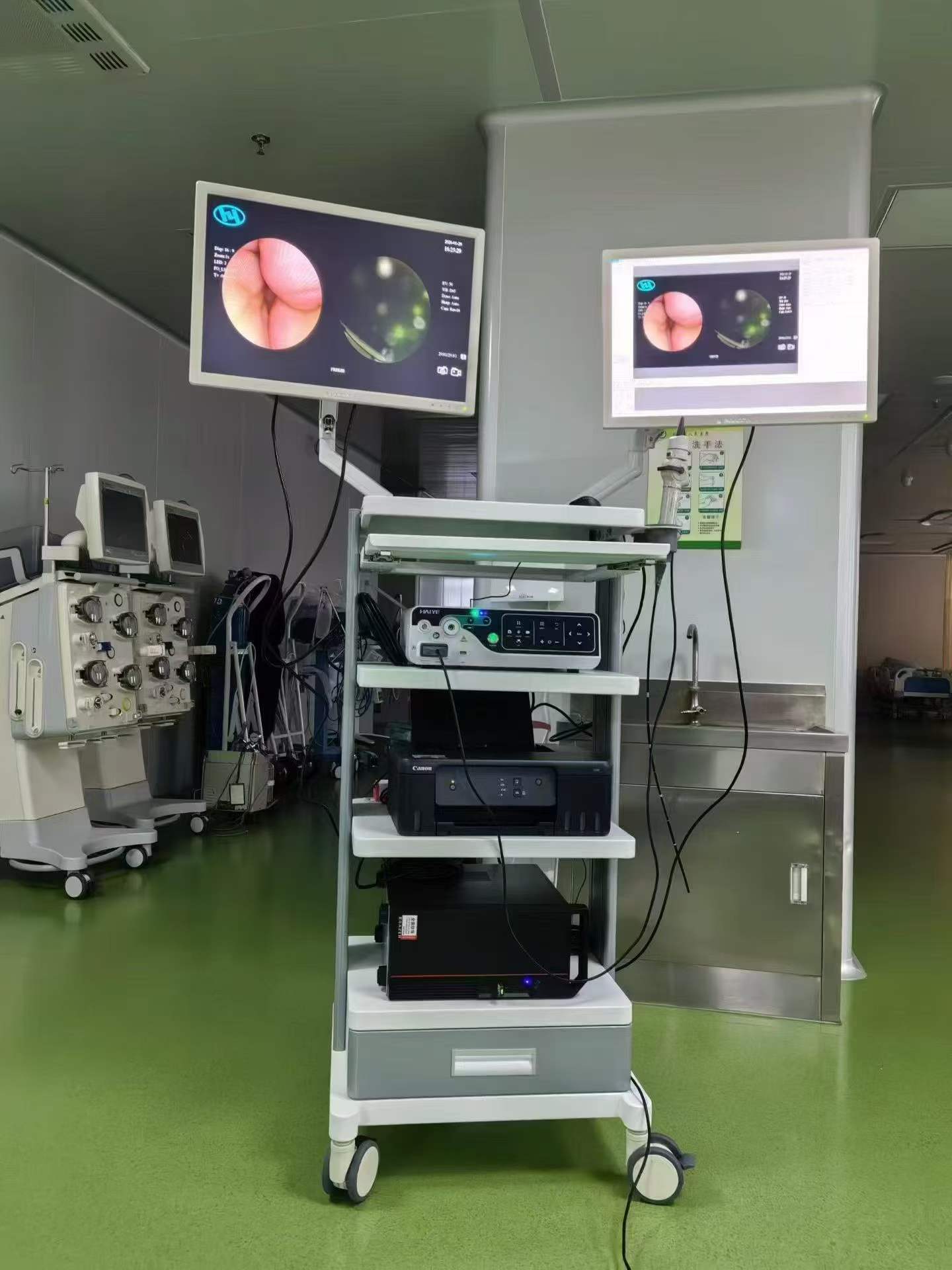 Electronic Bronchoscope