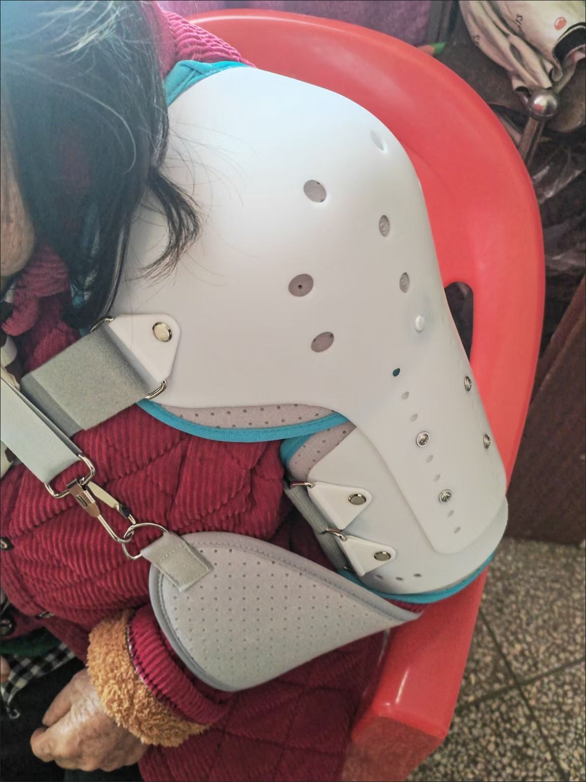 Adjustable Shoulder‑Elbow Fixed Orthosis Brace