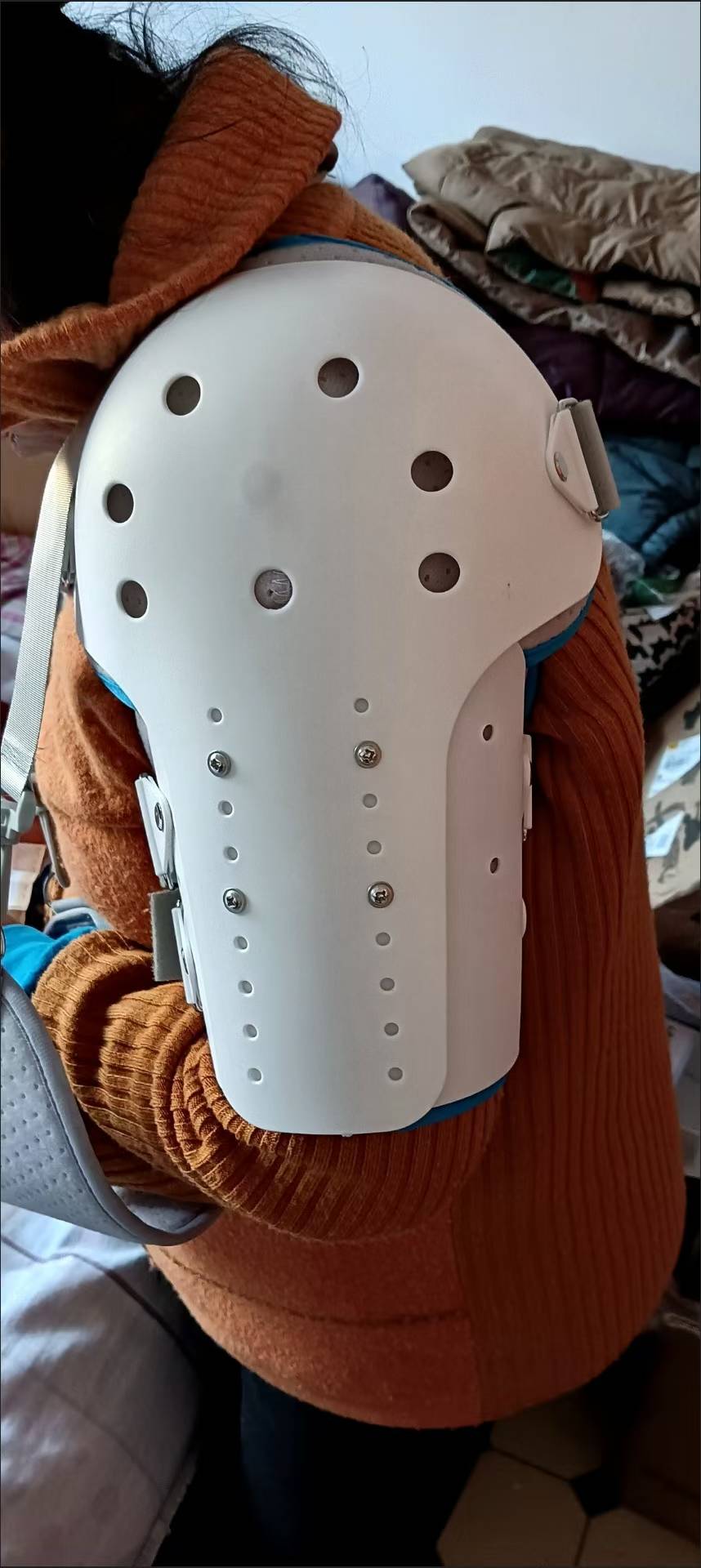 Adjustable Shoulder‑Elbow Fixed Orthosis Brace