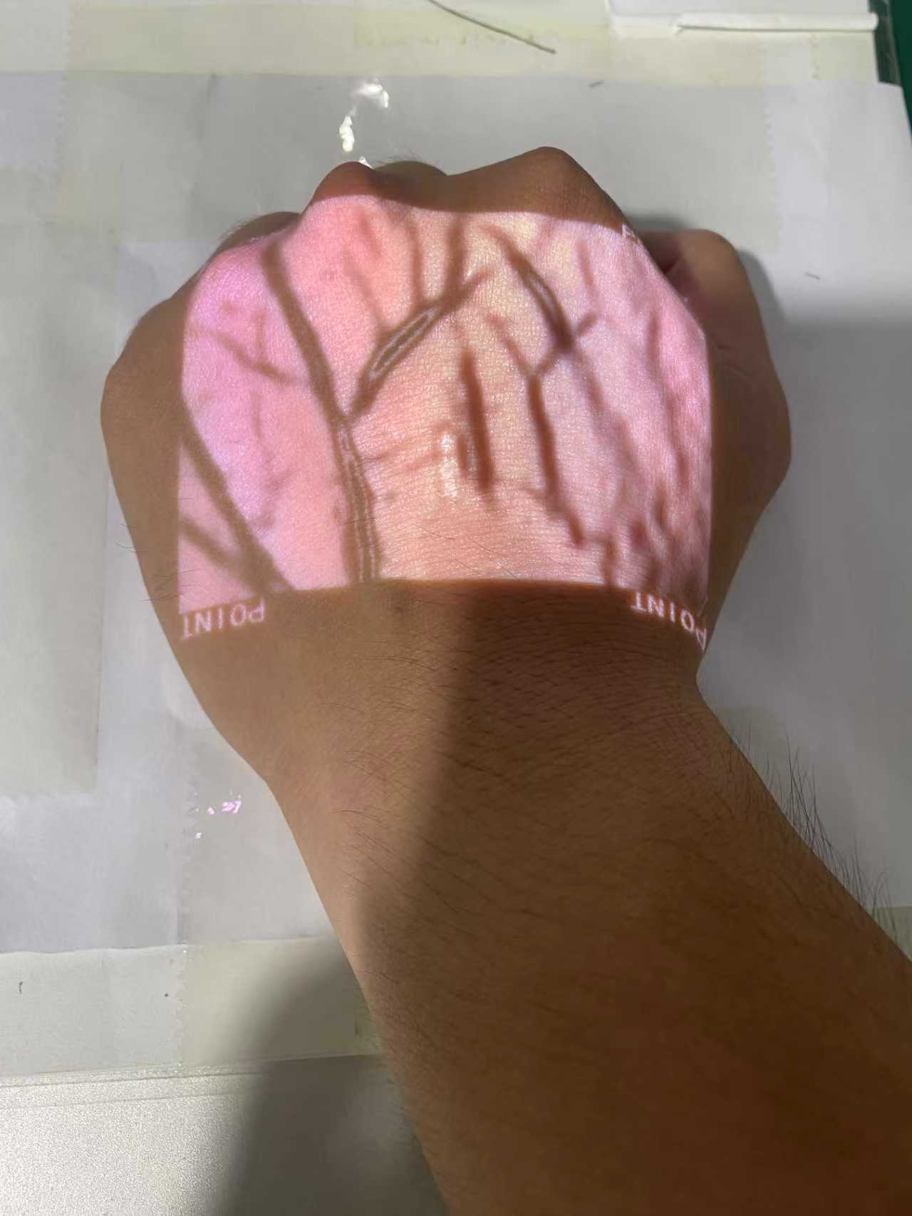 Vein Finder