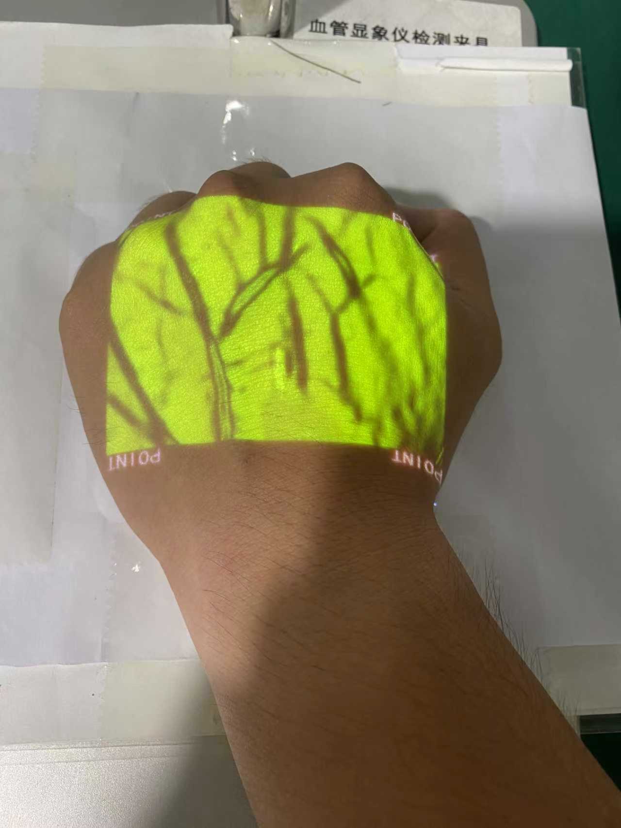 Vein Finder