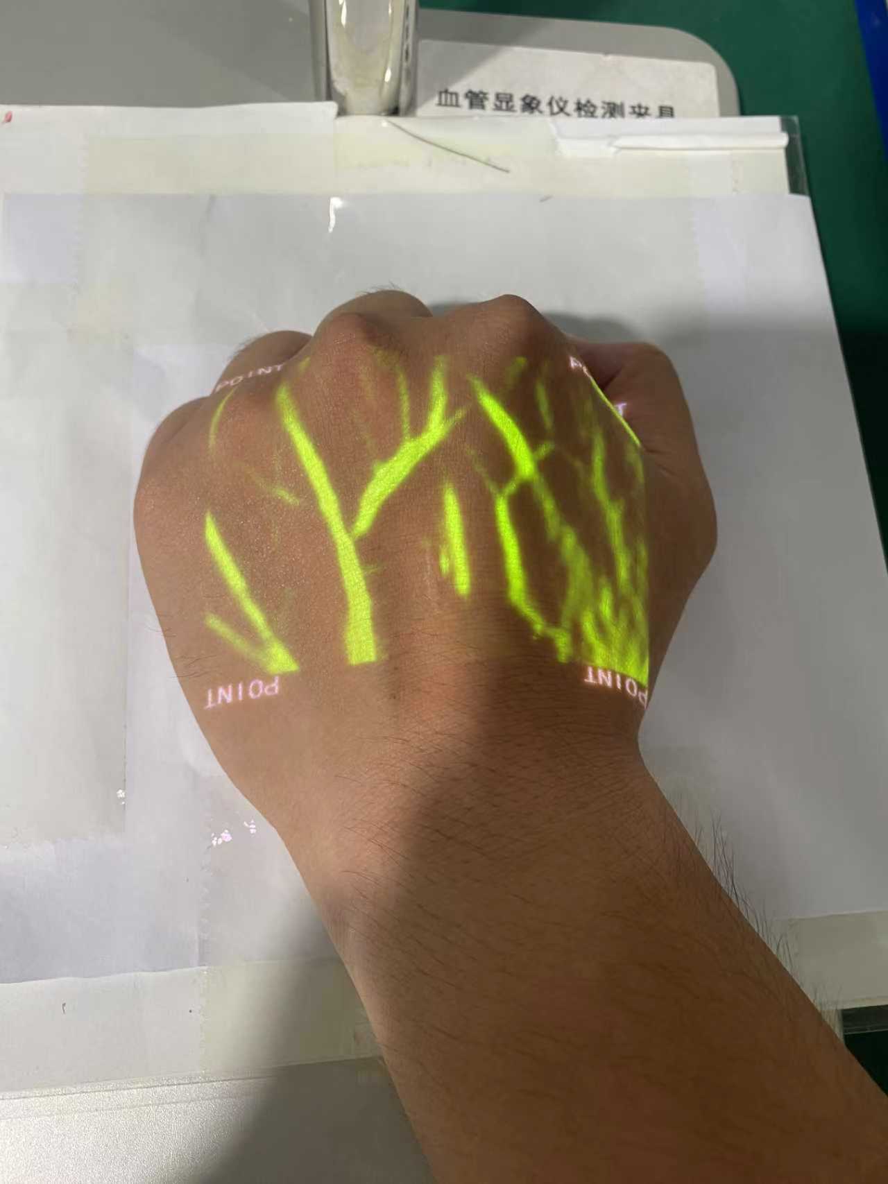 Vein Finder