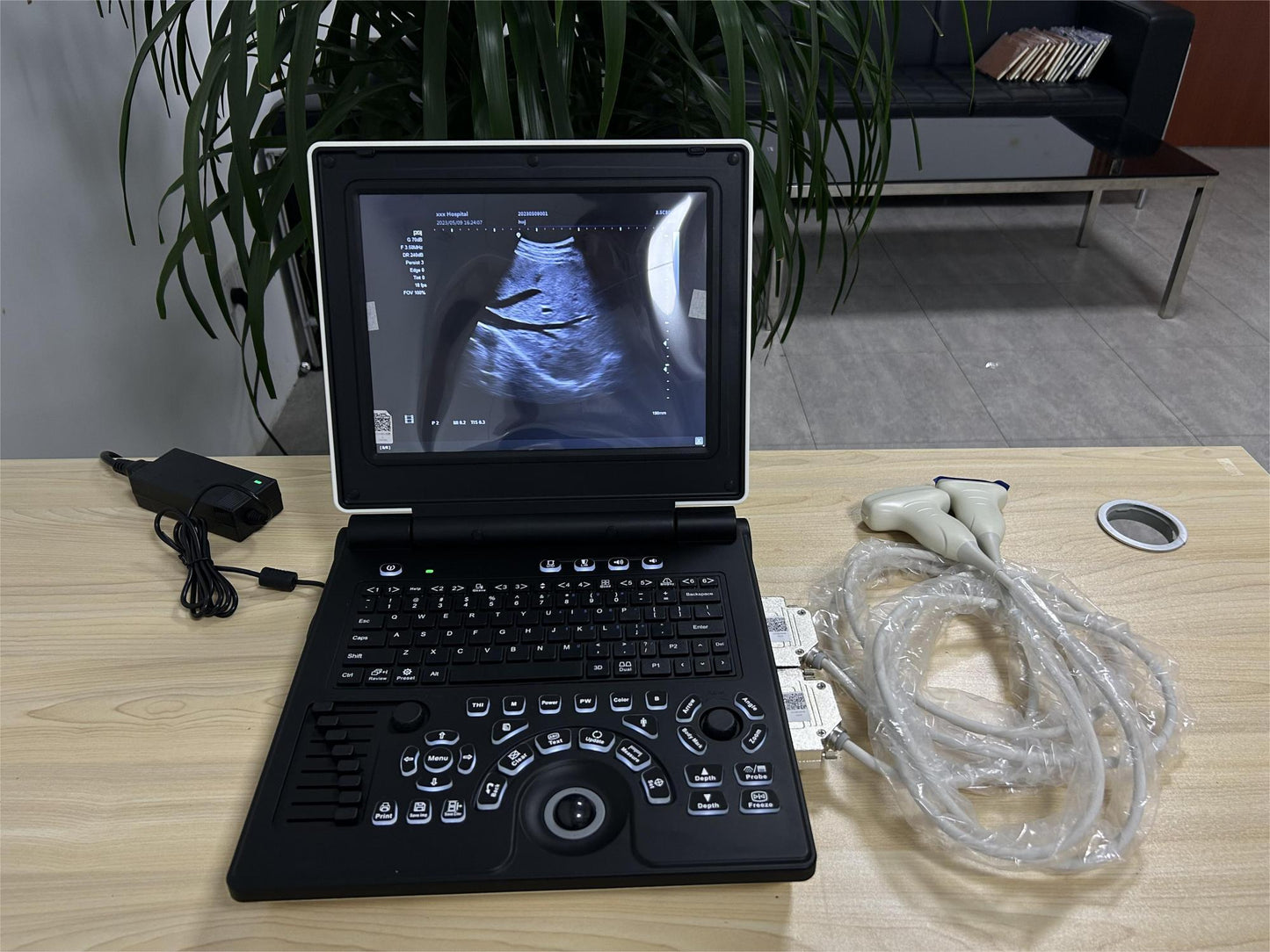 Color Doppler Ultrasound Diagnostic System