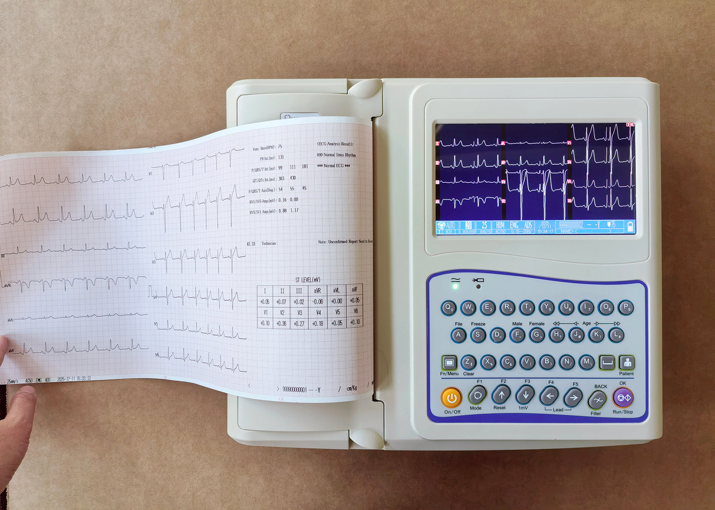 12 - Channel Electrocardiograph With Built - in Printer