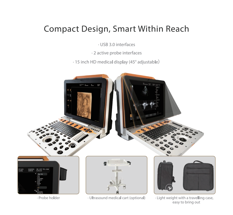 Portable Full Digital Color Ultrasonic Diagnostic Apparatus Diagnostic Ultrasound System