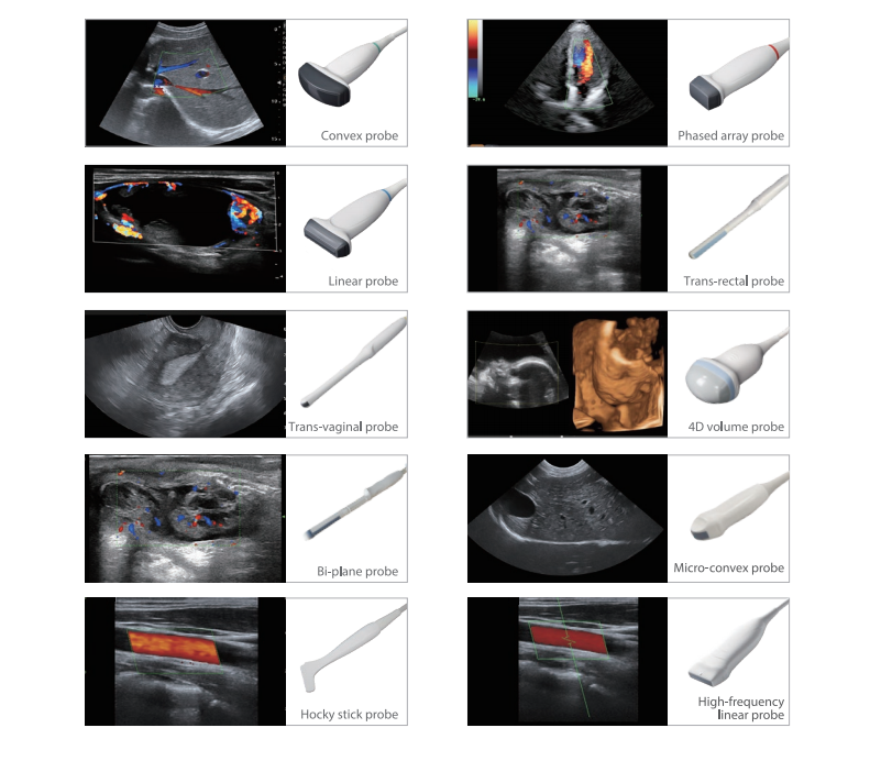 Portable Full Digital Color Ultrasonic Diagnostic Apparatus Diagnostic Ultrasound System