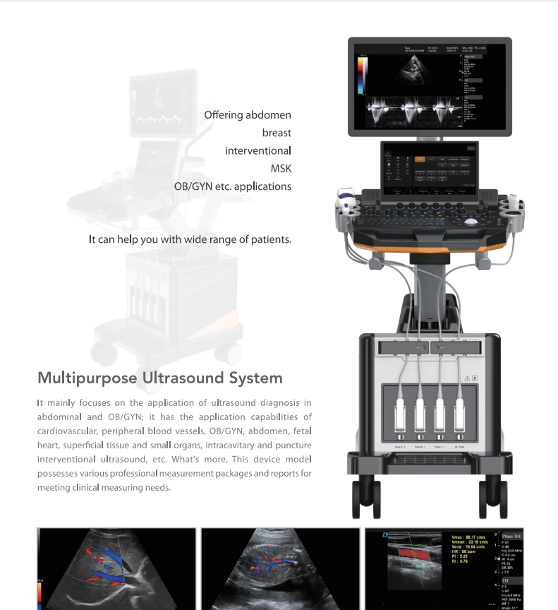 Trolley Color Ultrasonic Diagnostic Apparatus