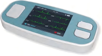 Portable ECG Monitor