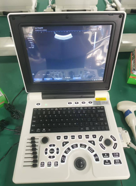 Full Digital Ultrasound with PW